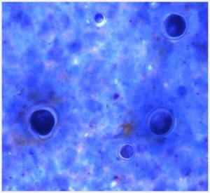blue stain sample with spherules