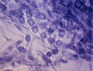 microscopic image of dimorphic soil fungus in mycelium form; indigo color