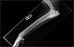 x-ray of leg