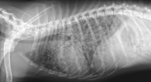 x-ray of Interstitial pattern