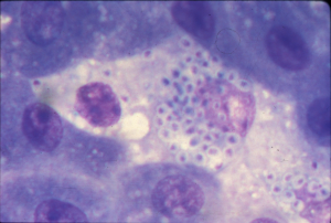 microscopic image of Histoplasma capsulatum var. capsulatum - yeasts are small, spherical, violet-colored and surrounded by a white halo
