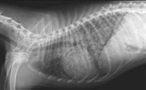 x-ray of Thorax – hilar lymphadenopathy, military to nodular interstitial pattern
