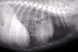 x-ray of lungs showing Miliary interstitial pattern