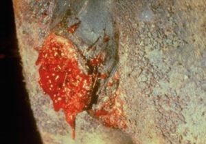 circular, ulcerative granulomas with a serosanguineous discharge