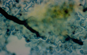 microscopic image of hyphae