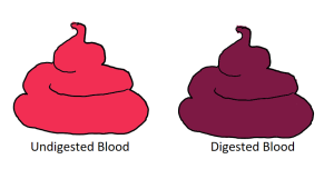 Drawing depicting the different colors of blood in stool.