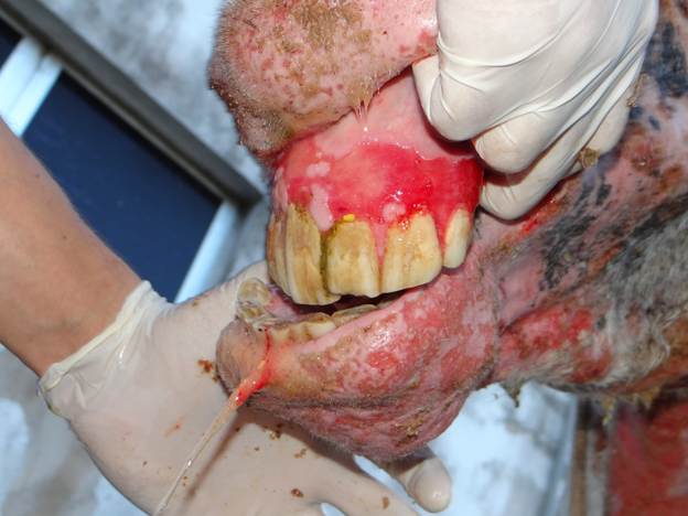 Same horse with bullous pemphigoid. The photo shows extensive ulceration/deep erosion on the gingiva. Multifocal to coalescing ulcerative to eroded lesions are present on the muzzle and chin.