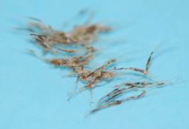 Hair shafts easily epilated from the legs of the dog with dog above