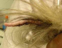 Extensive scarring alopecia and moderate scaling and crusting on the tail of the dog above.