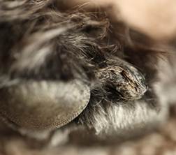 Dog with lupoid onychitis. The deformed nail shows longitudinal striations associated with breaking/brittleness of the claw plate (i.e. onychorrhexis)