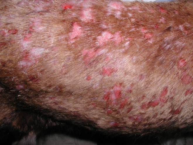 Multifocal to coalescing eroded and ulcerated lesions localized to the trunk of a dog with SJS/TEN. The mucocutaneous junctions and oral mucosa are also affected.