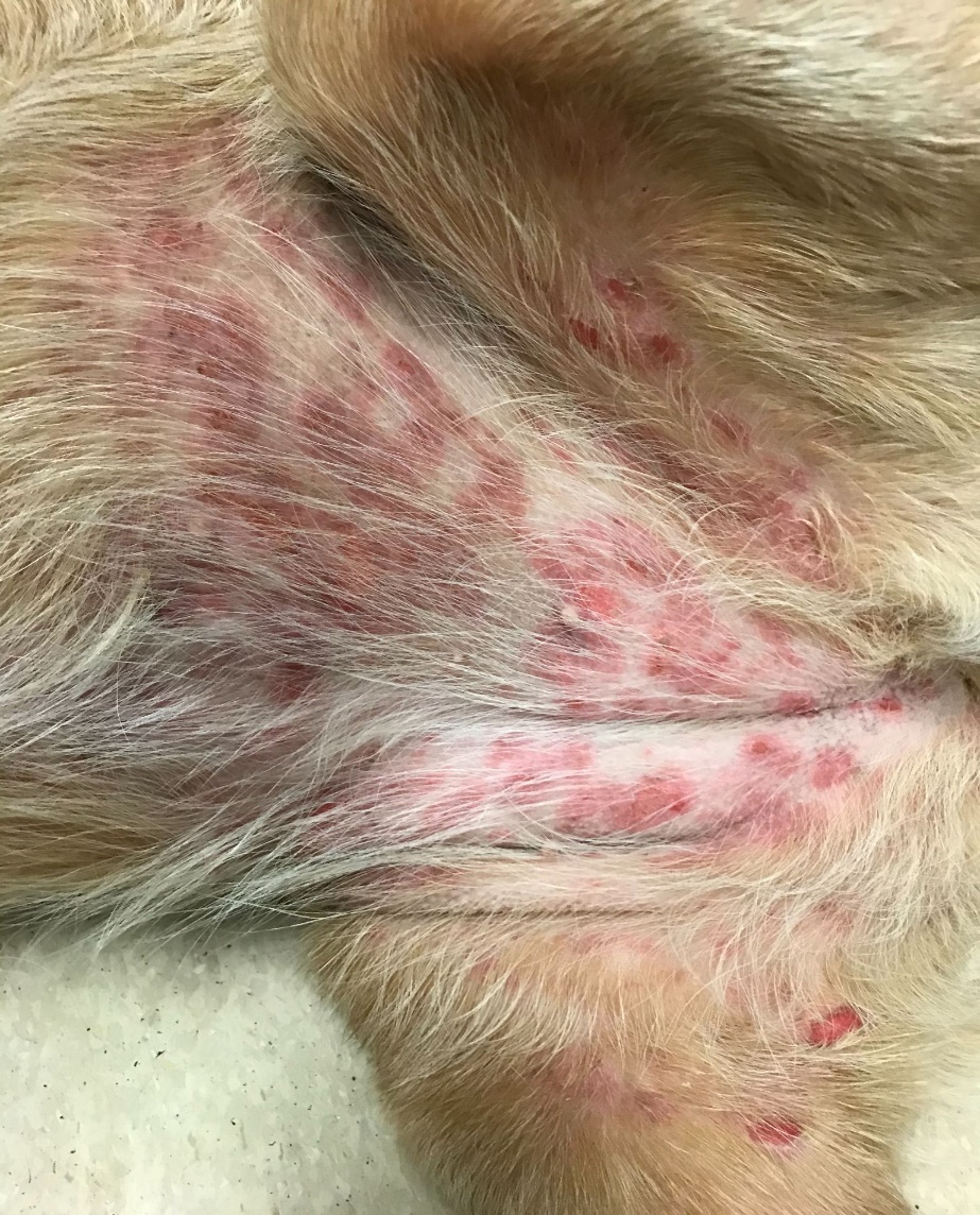 Multiple erythematous macules and patches localized to the ventrum and inner things of a Labrador retriever with TEN caused by a potentiated sulfa drug. Notice the ulcerated lesions on the inner thighs. Many other parts of the body are affected including mucosal sites.