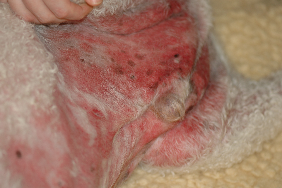 Marked erythematous macules coalescing to form diffuse erythema on the ventral abdomen, groin and inner thighs of a dog with suspect adverse drug reaction to ibuprofen. Note the edema associated with the lesions. Various other parts of the body are affected. The dog was lethargic and anorexic.