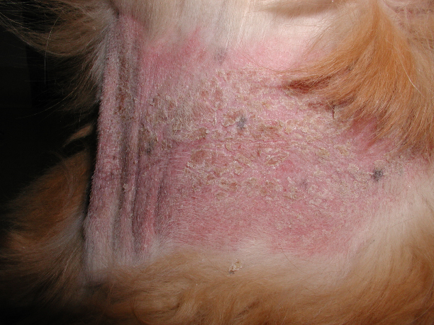 Notice the diffuse erythema and adhered scales on the ventral neck of a dog. The lesions developed after using a spray containing chlorhexidine and alcohol to treat a superficial pyoderma.