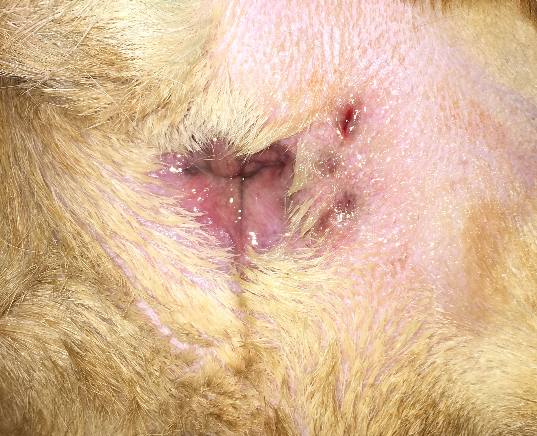 Diffuse erythema and various sinus tracts on the right aspect of the perianal region of a dog with cellulitis due to anal sac abscessation and rupture.