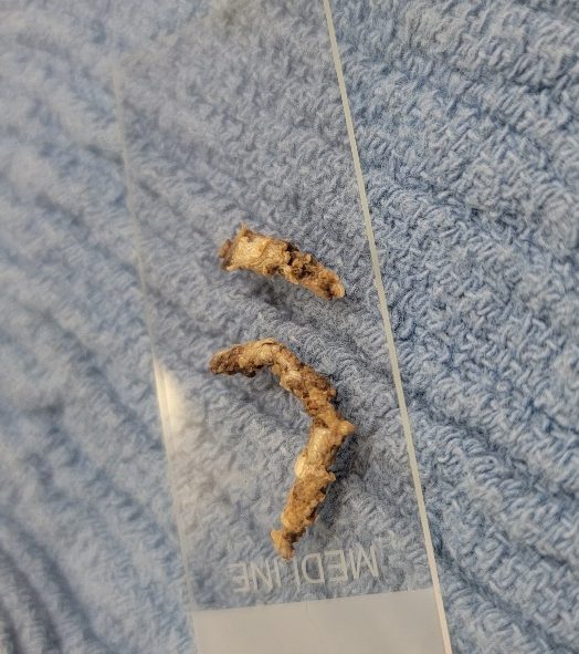Notice the tubular shape, dry and clay -colored anal sac content from a dog with impaction.