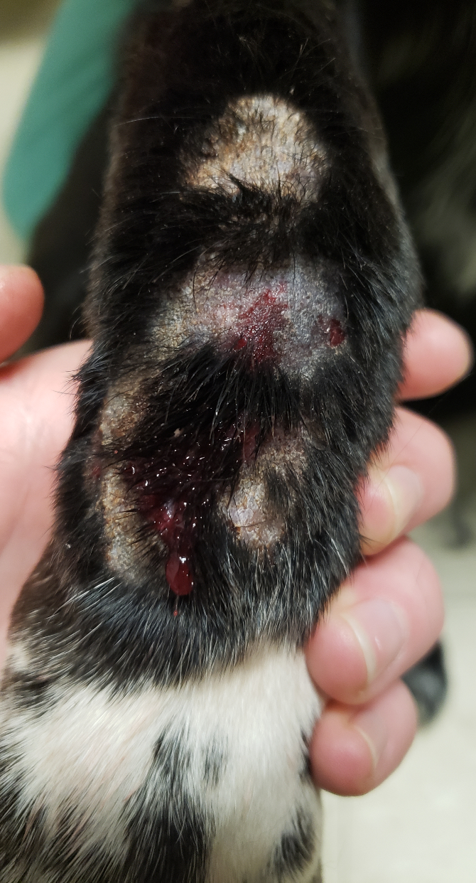 Notice the sanguineous-purulent exudate draining from areas of ruptured hair follicles (i.e. furunculosis) in a dog with acral lick dermatitis. Cytology showed large numbers of degenerate neutrophils with intra- and extra-cellular cocci bacteria indicating the presence of a secondary deep pyoderma.