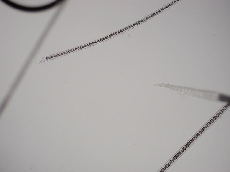 Notice the broken hair shaft tips. These hairs were gently plucked from areas of non-inflammatory alopecia to demonstrate to the owner that the cat was causing the hair loss.