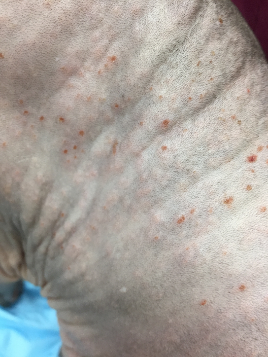 Multiple miliary lesions on the trunk of a cat with atopic skin syndrome (i.e. environmental allergy).