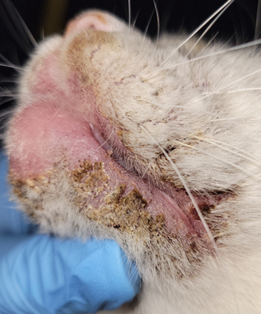 Coalescing erythematous plaques localized to the chin and perioral region of a kitten with PNOED. Thick, adhered to fragile, light brown to blackish crusts cover these lesions. The ears and various other body regions are also affected.